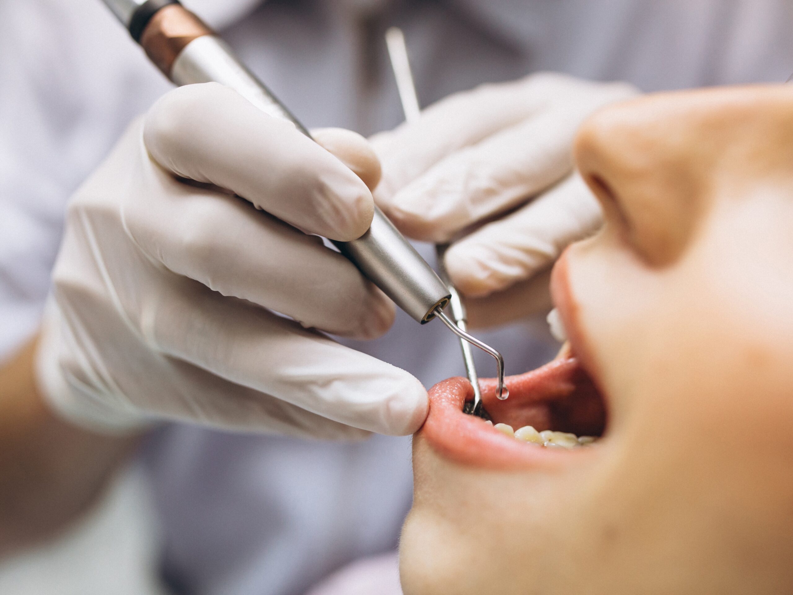 Smile brighter with our expert dental care treatment services, from routine cleanings to advanced treatments.