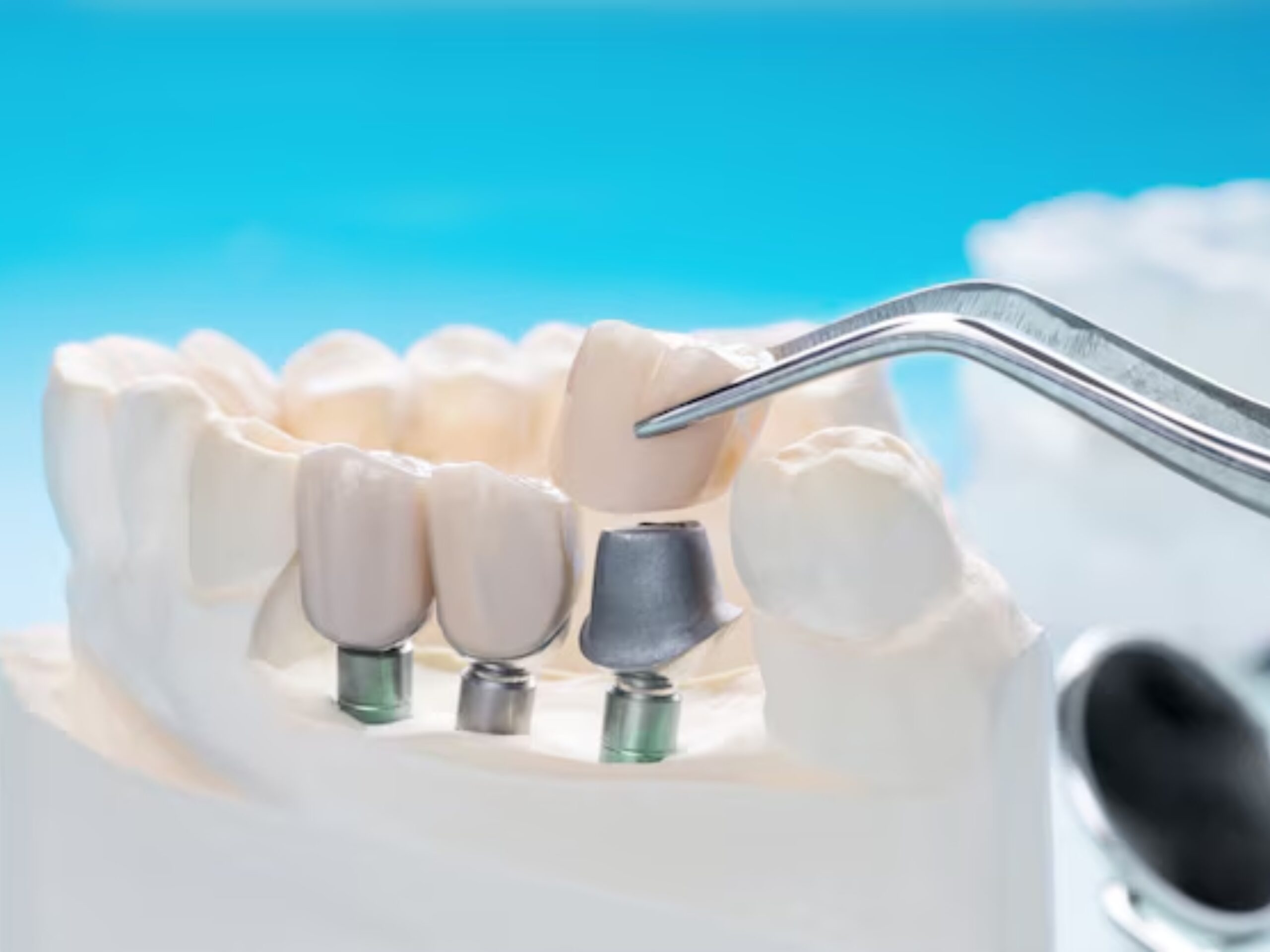 Smile brighter with our expert dental care treatment services, from routine cleanings to advanced treatments.