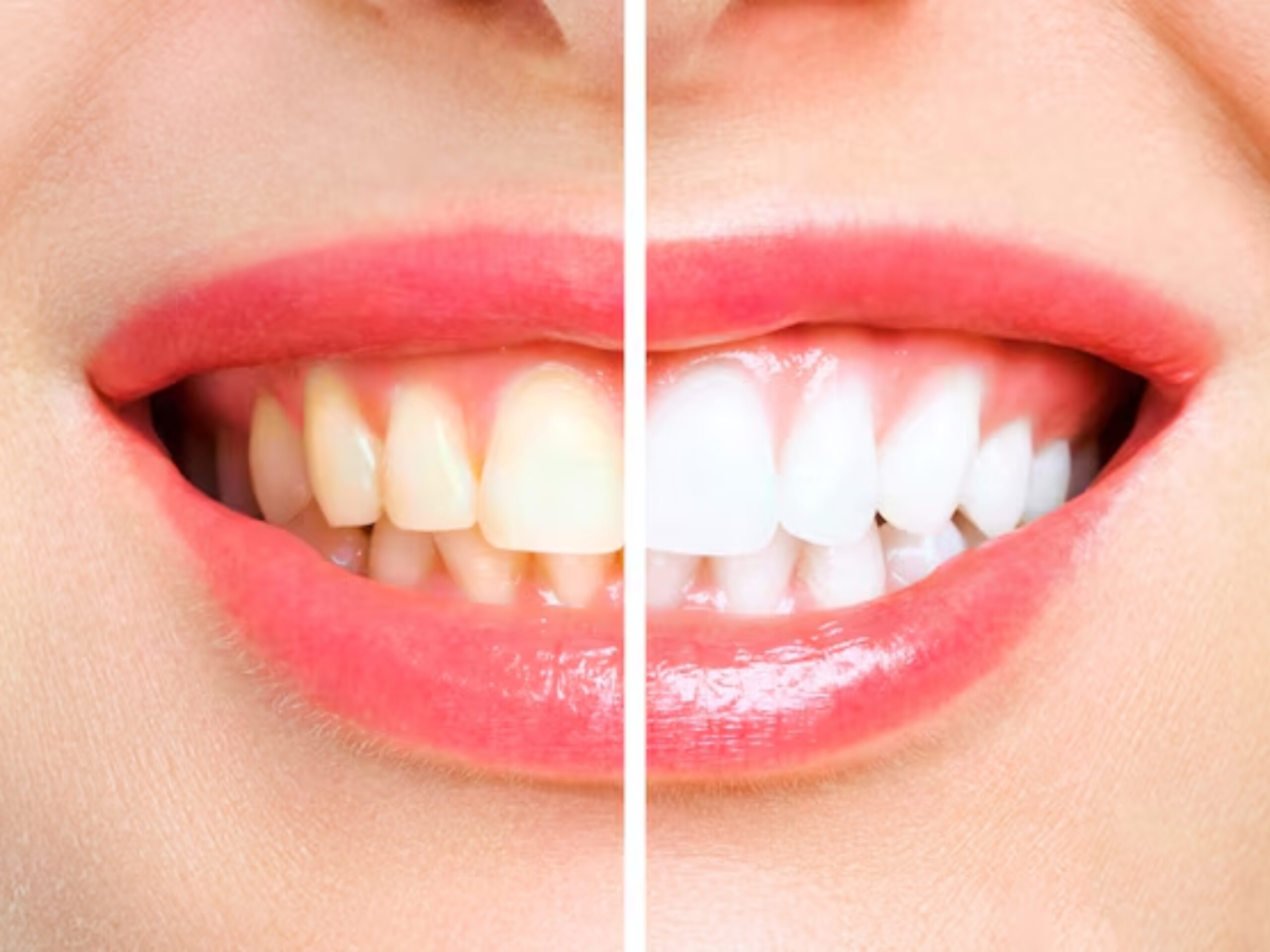 Smile brighter with our expert dental care treatment services, from routine cleanings to advanced treatments.