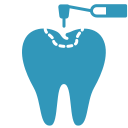 Fissure sealants are applied to the deep grooves of back teeth to block bacteria and prevent cavities.
