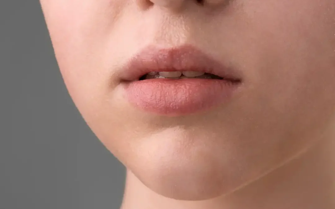 The Chapped Lips and Dry Mouth Trap: The Sneaky Reason Cavities Spike in Winter