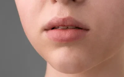 The Chapped Lips and Dry Mouth Trap: The Sneaky Reason Cavities Spike in Winter