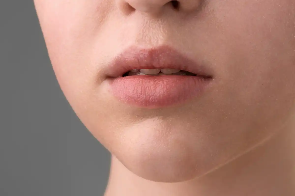 Close-up of a person's lower face showing dry, slightly chapped lips with visible peeling skin, highlighting lip dryness and dehydration.